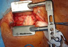 V Dublinu unijní směrnice MDR brání v péči o děti v_Dublinu