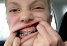 Nejsme kartel a ani nejdražší na světě, tvrdí čeští ortodontisté ortodontiste