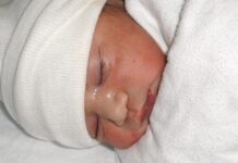 Riziko předčasného porodu i ztráty těhotenství se zjistí i z testu krve riziko_predcasneho_porodu