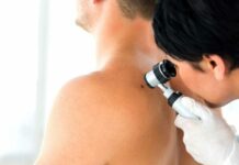 Vakcína na léčbu melanomu snižuje úmrtnost i recidivu melanomu