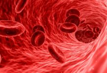 Trombóza vzniká kdekoli, nejčastěji ale v dolních končetinách tromboza