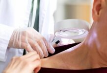 V Česku se rodí nový screening časného záchytu kožních nádorů koznich