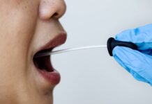 Riziko trombózy odhalí i stěr z úst. Zdarma ho nabídne Masarykova nemocnice trombozy