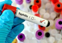 Výskyt syfilisu je v USA nejvyšší od roku 1950 syfilisu
