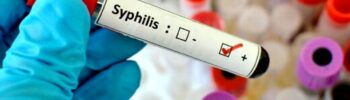 syfilisu