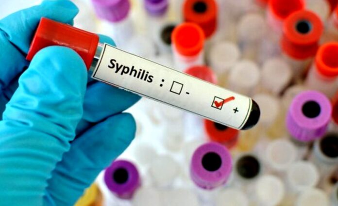 syfilisu