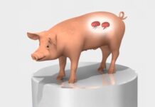 Žena, které transplantovali prasečí ledvinu, se těší dobrému zdraví ledvinu