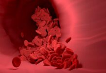 Mladí hemofilici už krvácení do kloubů neznají, a to je dobře hemofilie