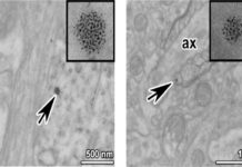 Za boomem Alzheimerovy nemoci stojí i nanočástice olova v ovzduší nanocastice