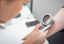 Melanom se u mužů objeví spíše na trupu, u žen na končetinách melanom