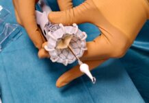 Ve VFN unikátně vyměnili chlopeň za jinou z hovězího osrdečníku Lekari