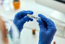 Chřipka nebo covid? Na tom nesejde, první léčba je stejná covid