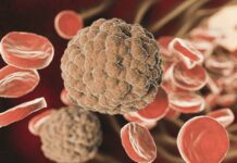 Systémový lupus: Nemoc mnoha tváří a vzpoura imunitního systému lupus