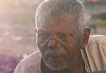 Lepra je sice tropická nemoc, ale máme ji i v Evropě lepra