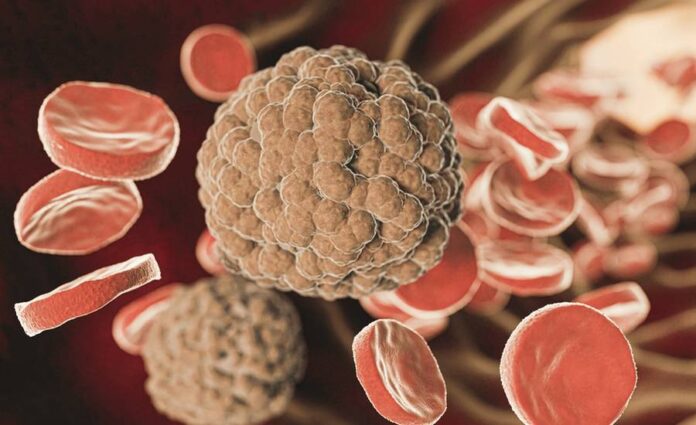 myeloidni_leukemie myeloidni_leukemie