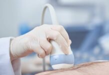 Screeningu výdutě břišní aorty se muži nebojí. Odmítne ho 15 % z nich vydute_brisni_aorty