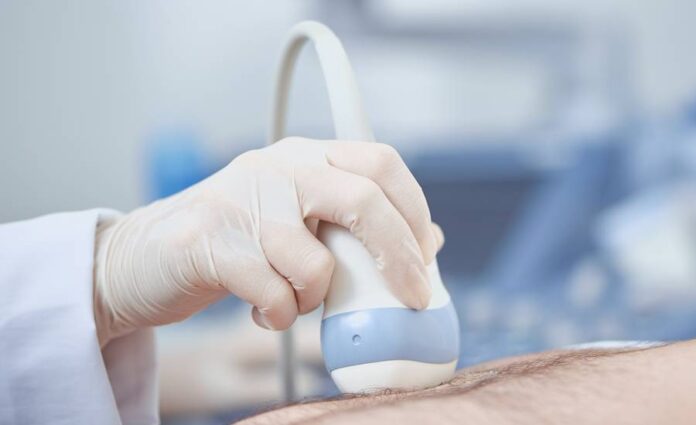 vydute_brisni_aorty vydute_brisni_aorty