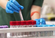 Infektolog: Žloutenka udeřila, protože tady dlouho nebyla zloutenka