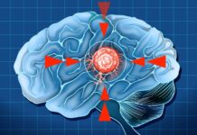 Pražská VŠCHT zahájí výzkum léku na agresivní nádor v mozku u dětí nador_v_mozku