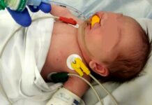 Richtrová z FN Brno získala cenu za obturátor pro děti s rozštěpem